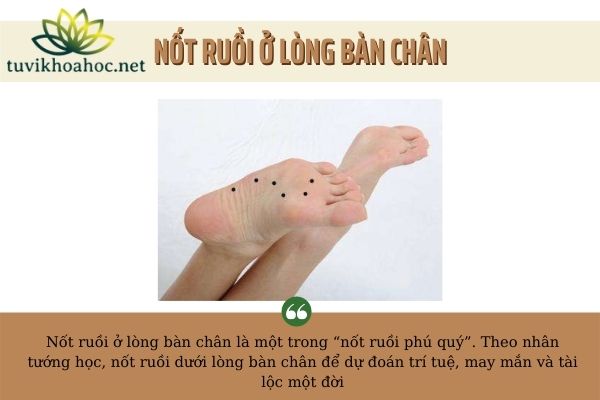 6 nốt ruồi ở lòng bàn chân